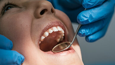 Zahngold: Warum sich eine professionelle Bewertung lohnt – und worauf man achten sollte Zahngold: Warum sich eine professionelle Bewertung lohnt – und worauf man achten sollte - Behandlung beim Zahnarzt